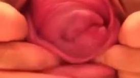 大开眼界啊 能把自己浪屄和菊花玩成这样也绝啦 前面是子宫脱垂后面是脱肛 是不是废了
