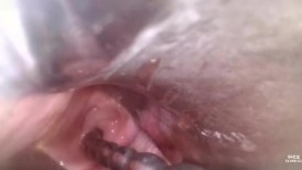 FC2 4867433 桃香酱的危险一天 子宫扩张 严重不孕症治疗 #7-2